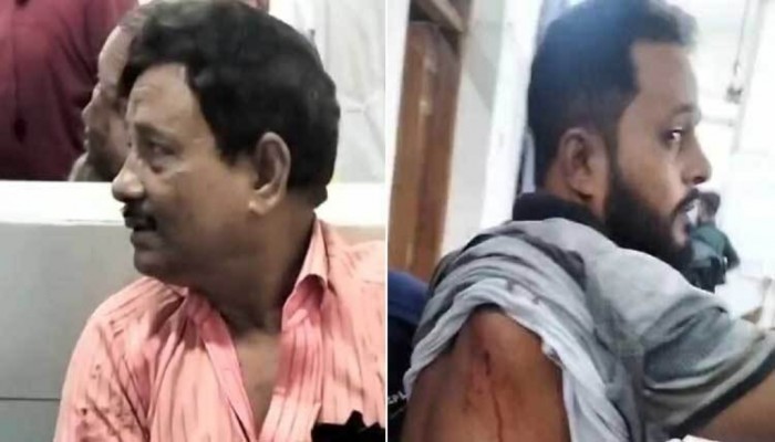 মোহাম্মদপুরে কাঁচাবাজার মার্কেট দখলকে কেন্দ্র করে গুলিবিদ্ধ ২ মোহাম্মদপুরে কাঁচাবাজার মার্কেট দখলকে কেন্দ্র করে গুলিবিদ্ধ ২