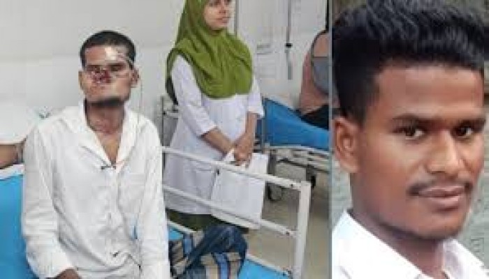 প্রথম সাক্ষ্য দিলেন গুলিতে মুখাবয়ব হারানো খোকন চন্দ্র প্রথম সাক্ষ্য দিলেন গুলিতে মুখাবয়ব হারানো খোকন চন্দ্র